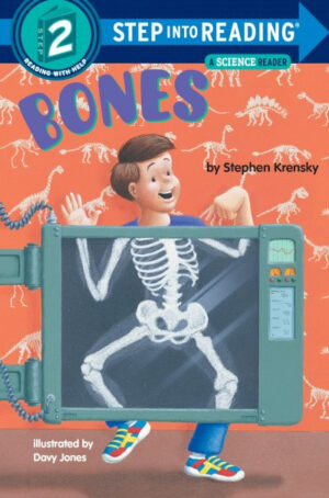 SIR: Bones